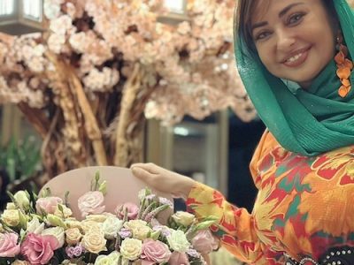 تغییر چهره ناگهانی بازیگری که عشق صداوسیماست