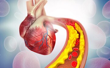 نوشیدنی‌های دم دستی برای کاهش کلسترول